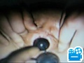 a2m.flv